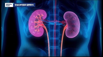 [메디컬플러스] 만성신부전증의 혈액투석 _ 김소미 교수(단국대병원 신장내과)