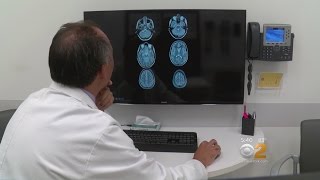 Dr. Max Gomez: Concussion Study