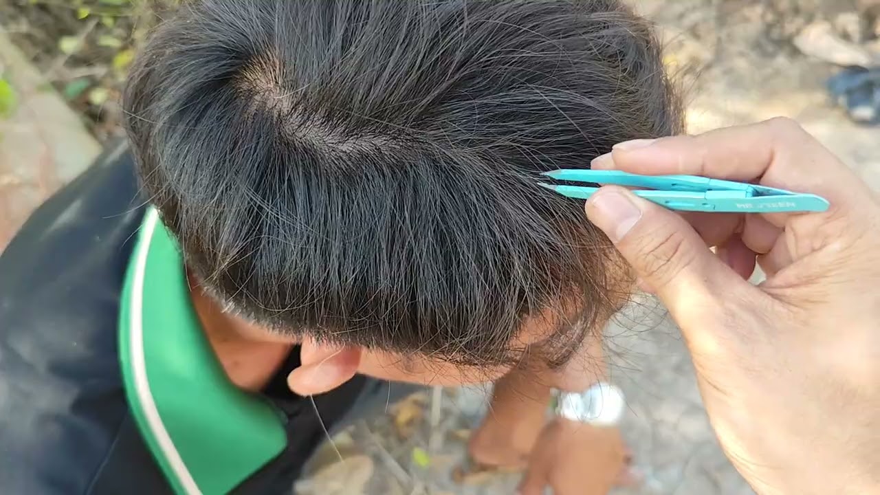 PLUCK WHITE HAIRS, nhổ tóc bạc cho anh ba Thà bằng nhíp MR GREEN 