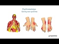 What is erythromelalgia