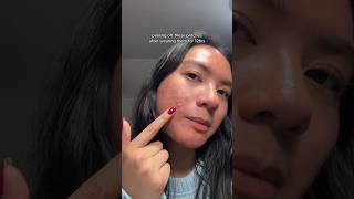 wore these patches for 12 hours so let’s see what came off #foryou #fypage #asian #filipino #newyork wore these patches for 12 hours so let’s see what came off #foryou #fypage #asian #filipino #newyork