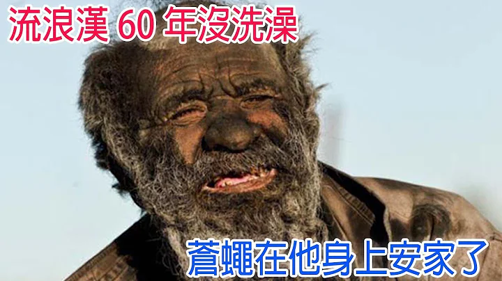 流浪漢60年沒洗澡，比很多人都長壽，蒼蠅在他身上安家了 【鄉民看世界】 - 天天要聞