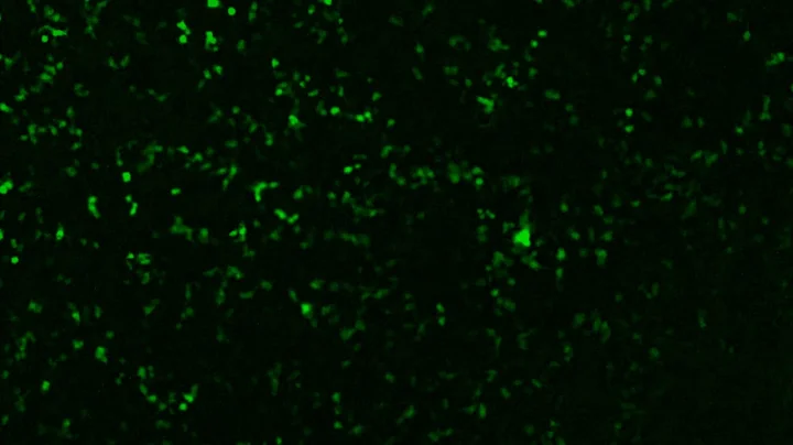Timelapse of GFP transfected cells fluorescence CytoSMART Lux microscope