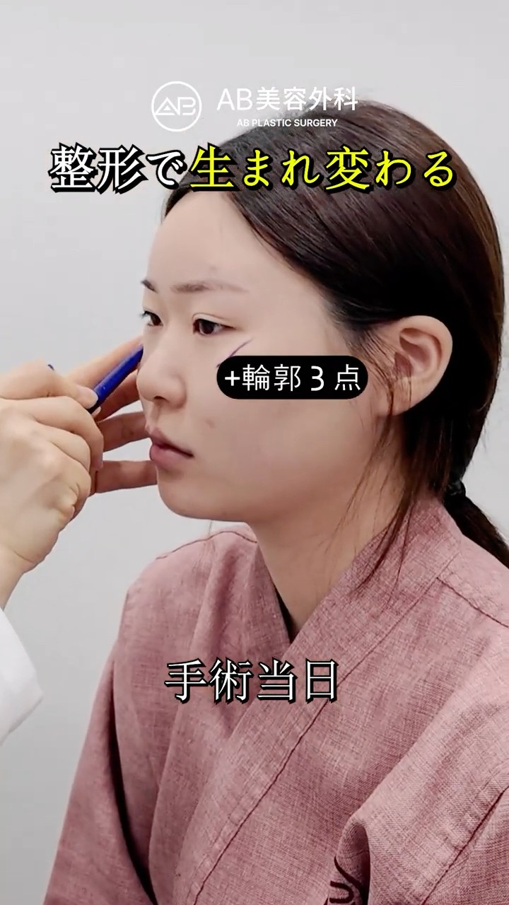 整形で別人級に…目・鼻・輪郭のフル変身 #shorts