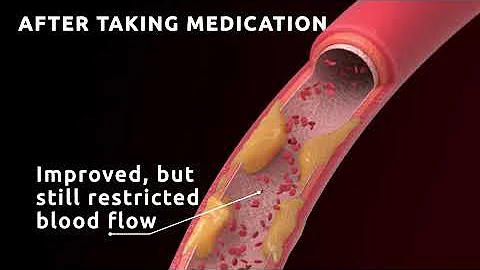 ED: Why does viagra and cialis stop working?