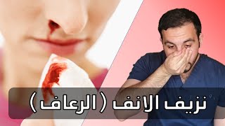 كيف تتعامل مع نزيف الانف الرعاف