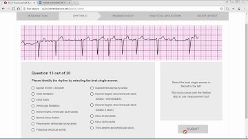 ACLS Precourse ECG Rhythm