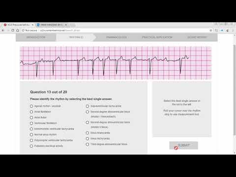 Infografia Top 5 Changes To Acls 15 Aha Guidelines Highlights 健康跟著走