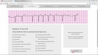 ACLS Precourse ECG Rhythm screenshot 3