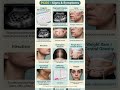 PCOS Explained | Signs & Symptoms of Polycystic Ovary Syndrome | Gynecology #medicalstudents