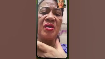 Tiêu u tuyến giáp . Quỳnh Hương thảo dược ĐT: 0969895015