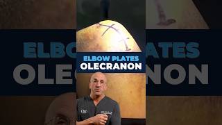 What Happens When You Break Your Elbow? #orthopedicsurgery #injury #medical