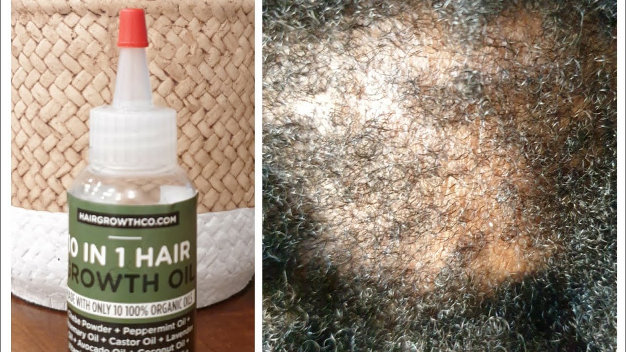 Hair Growth Oil/Hairgrowthco/10 In 1Hair Growth Oil/ 7days hairgrowth