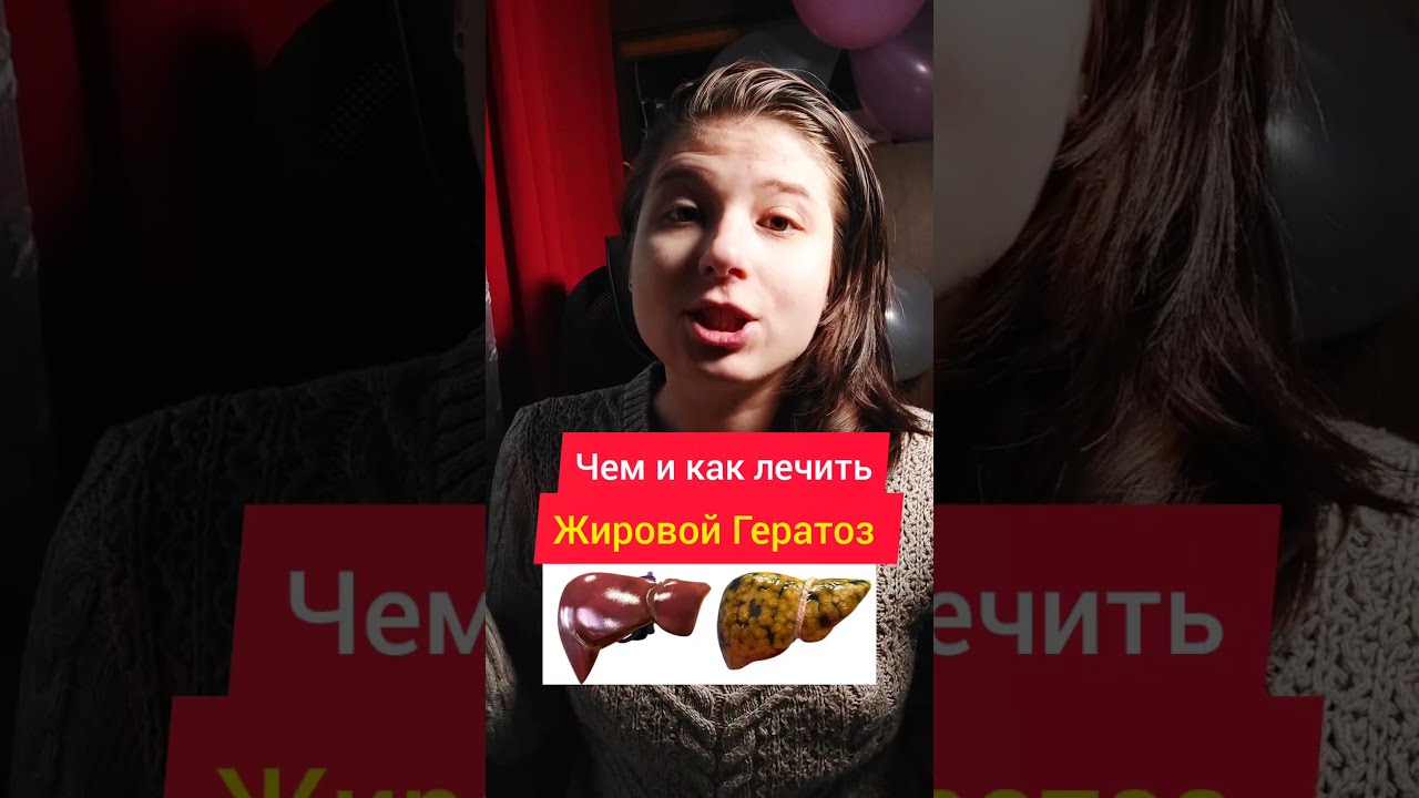 Лечение Жирового Гепатоза