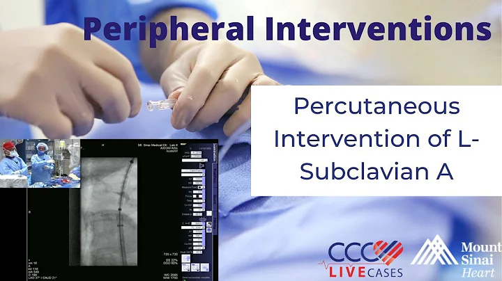 Percutaneous Intervention of L-Subclavian A - June 26, 2013 Live Case Video