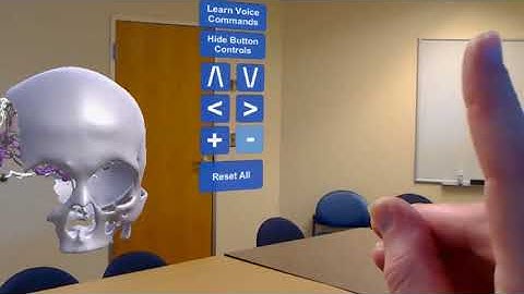 Hololens example - human skull and brain blood vessels