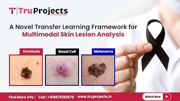 A Novel Transfer Learning Framework for Multimodal Skin Lesion Analysis