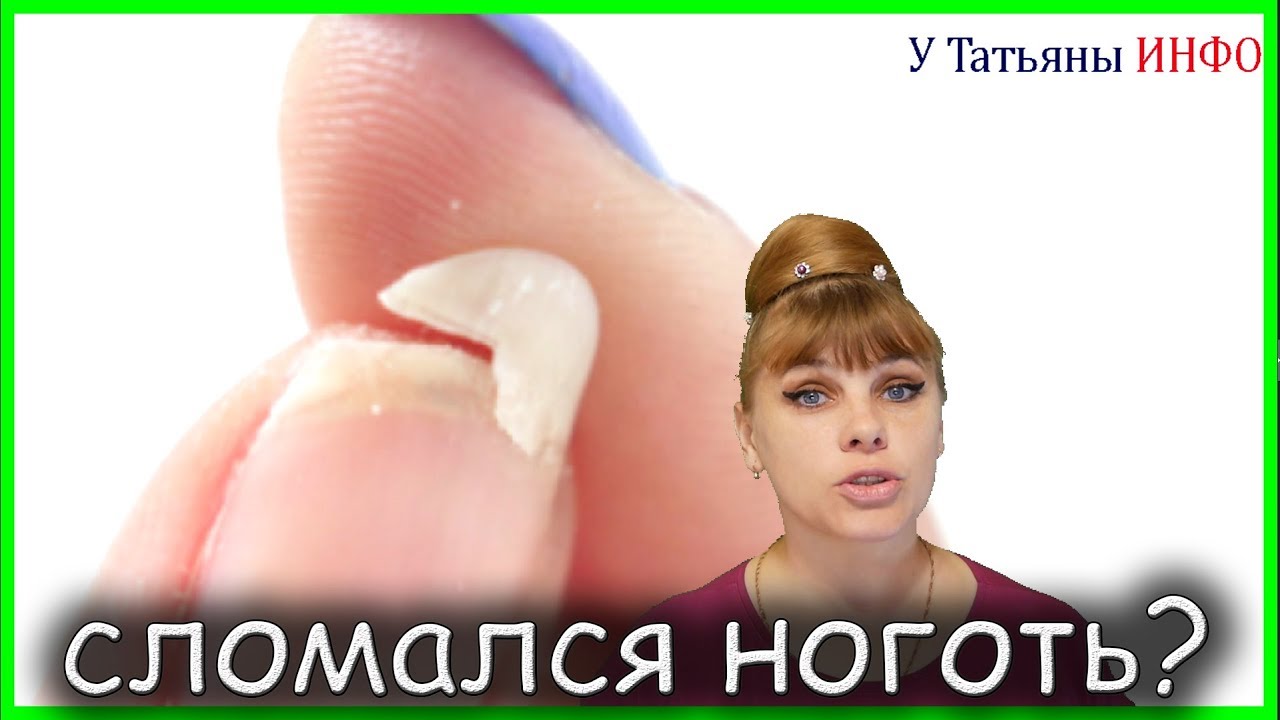 О том, как УКРЕПИТЬ ломкие, слоящиеся, хрупкие НОГТИ к зиме!!! - YouTube