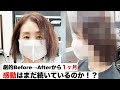 【縮毛矯正失敗のリペアから1ヶ月後】酸性ストレートの感動から1ヶ月は果たしてどうなっているのか!?#酸性ストレート #ビビリ毛 #縮毛矯正