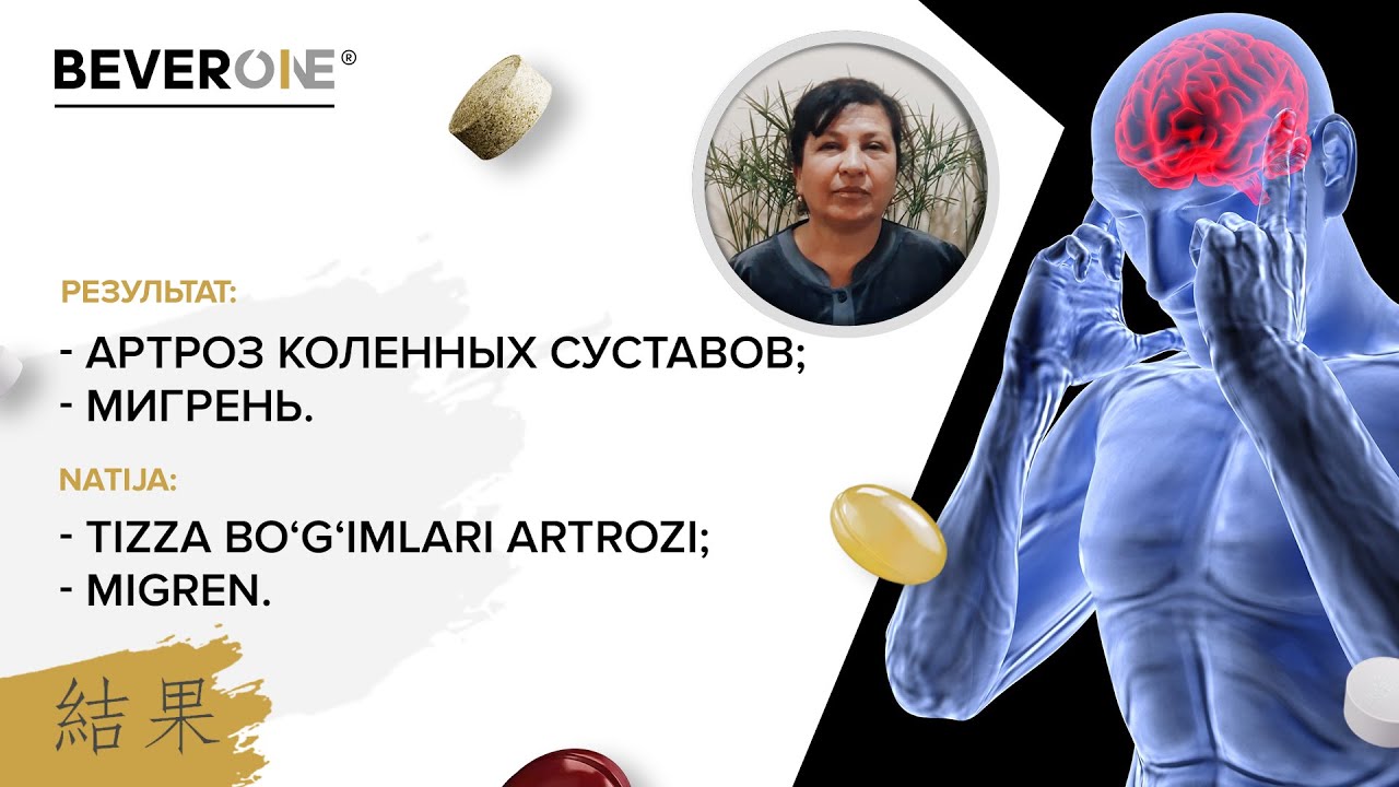 Артроз коленных суставов, мигрень - Результат | BEVERONE - YouTube