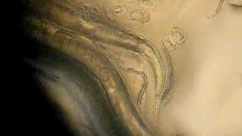 C.elegans rol-1 mutant