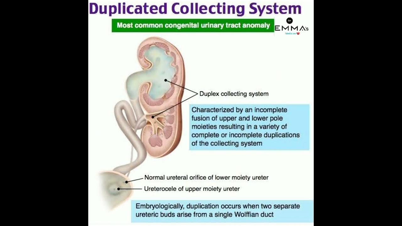 duplicated-collecting-system-youtube