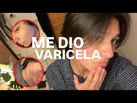 STORYTIME - ME DIO VARICELA / Letrosic