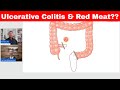 Ulcerative colitis  red meat warning kentcarnivore