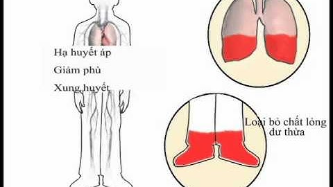 Lợi ích thuốc lợi tiểu trong điều trị suy tim