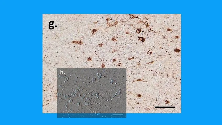 6A27EC47DBE4041F65BD05B97FED9A#1