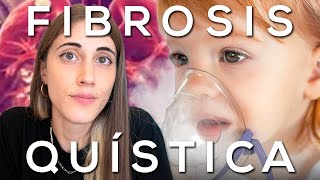 Thumbnail image for ¿Por qué la FIBROSIS QUÍSTICA todavía no tiene CURA?