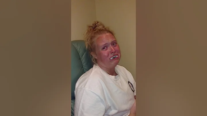 Best of wisdom teeth removal!