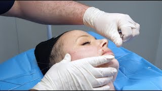 Silhouette Soft ThreadLift | Live Procedure at The Laser and Skin Clinic screenshot 2