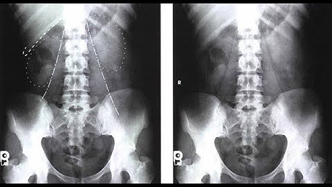 Abdomen - Radiographic Positioning