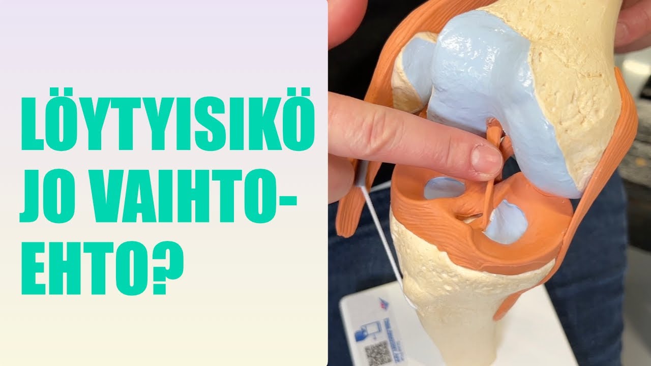 Onko ACL-leikkaus ja kuntoutus jäänyt ajassa jälkeen vuonna 2026? Ortopedi vastaa.