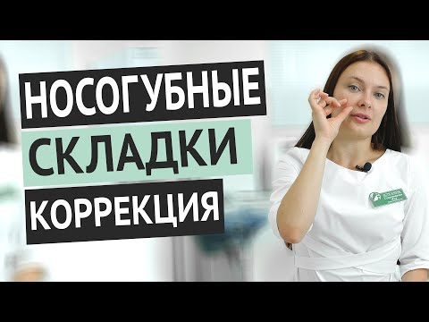 ВСЕ о коррекции НОСОГУБНЫХ СКЛАДОК. Современный подход