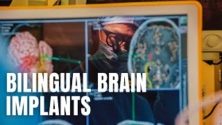 Breakthroughs in Bilingual Brain Implantation