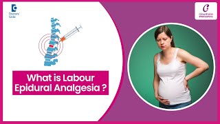 How an epidural is given during childbirth -Dr.Lavanya Gadi at Cloudnine Hospitals | Doctors