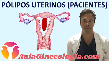 ¿Se ven pólipos o miomas en la ecografía?