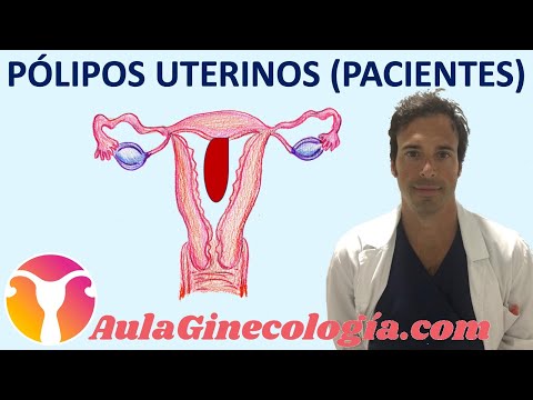 PÓLIPOS UTERINOS (PACIENTES):