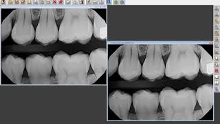 VixWin Platinum 3.5 - Acquiring Images in the Windows Layout View