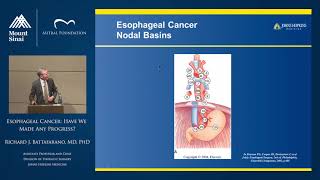 Esophageal Cancer: Have We Made Any Progress?