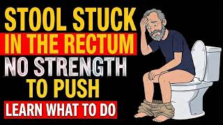 Stool STUCK in the Rectum! What is it and what to do Doctor Explains