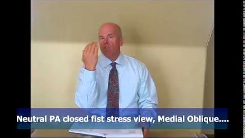 Carpal Tunnel Syndrome and Carpal Instability   Perry J. Carpenter DC QME