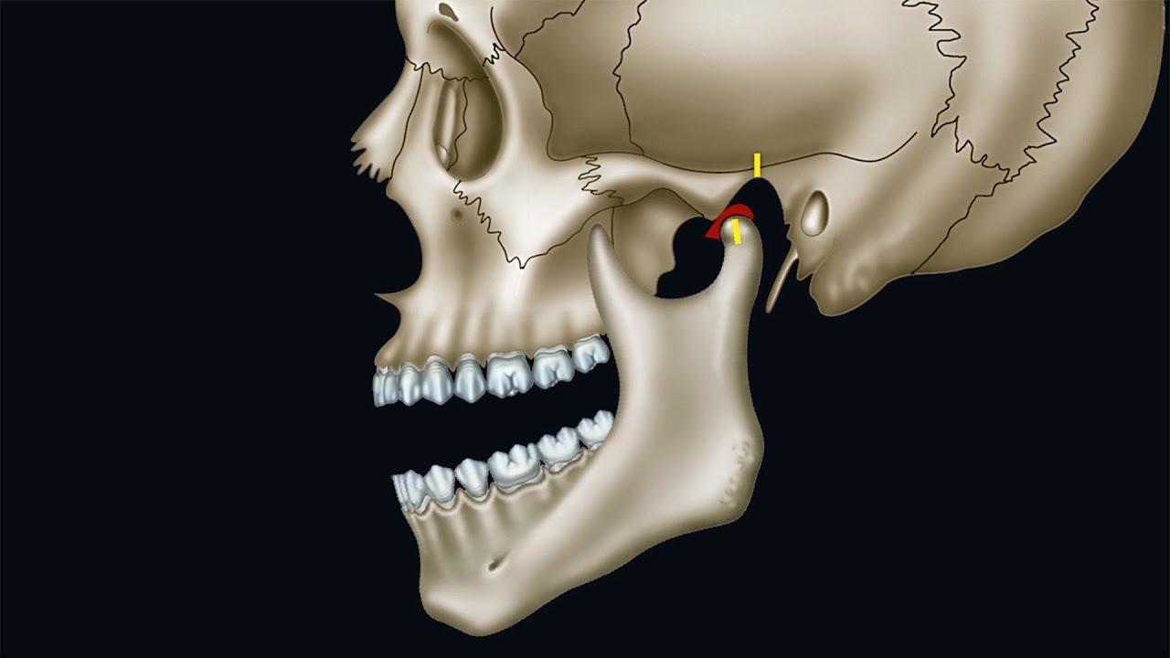 04 Abduktion (Öffnungsbewegung) - Unterkieferbewegung als Funktion des Kiefergelenks - YouTube