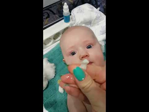 Как почистить носик малышу от козывок
