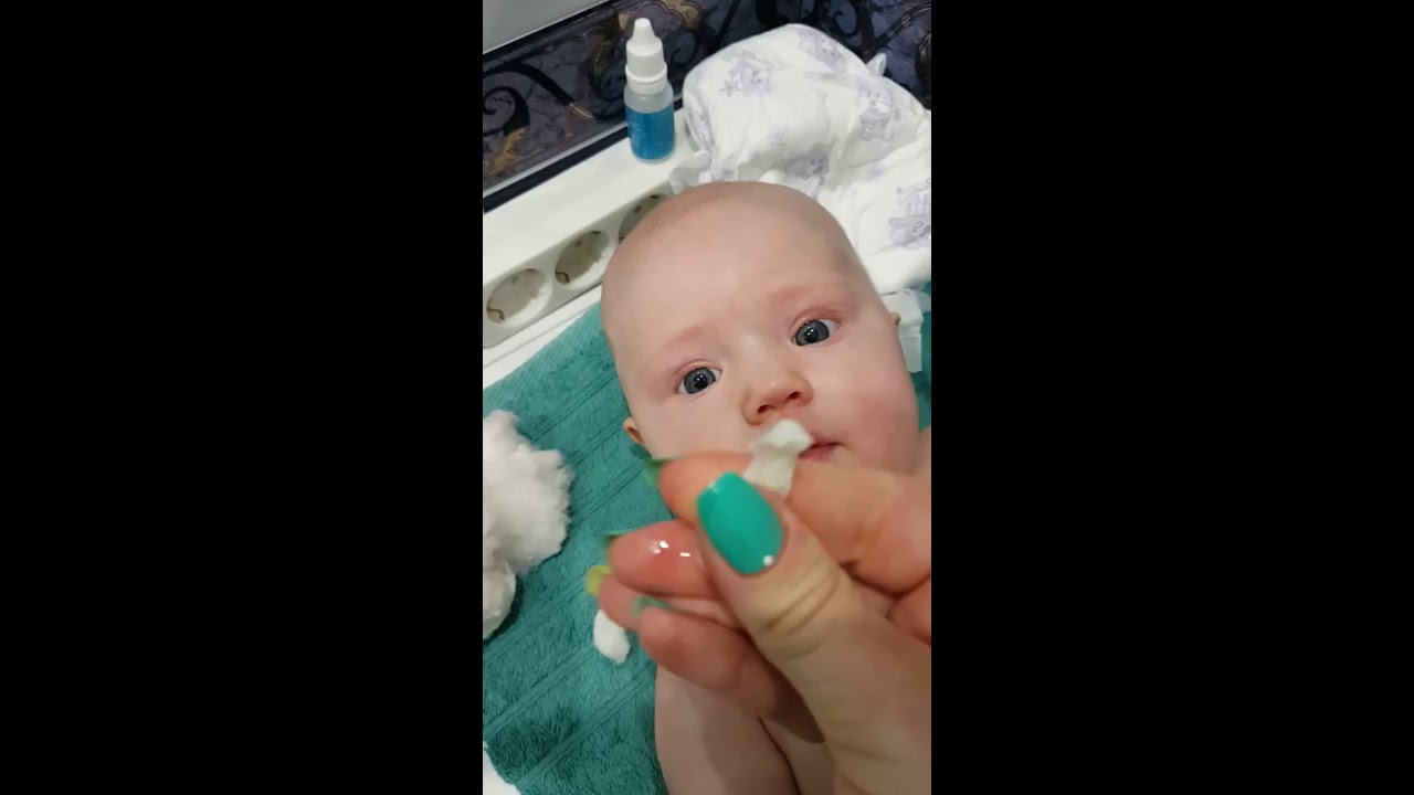 Ребенок год хрюкает носом