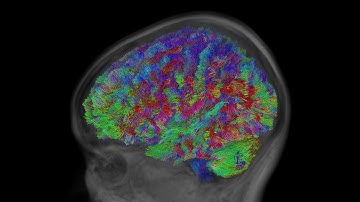 Single-Shell 3-Tissue CSD (SS3T-CSD) tractography