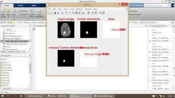 Detection and Classification of Brain Tumours using k-means with SVM, ANN and Decision tree