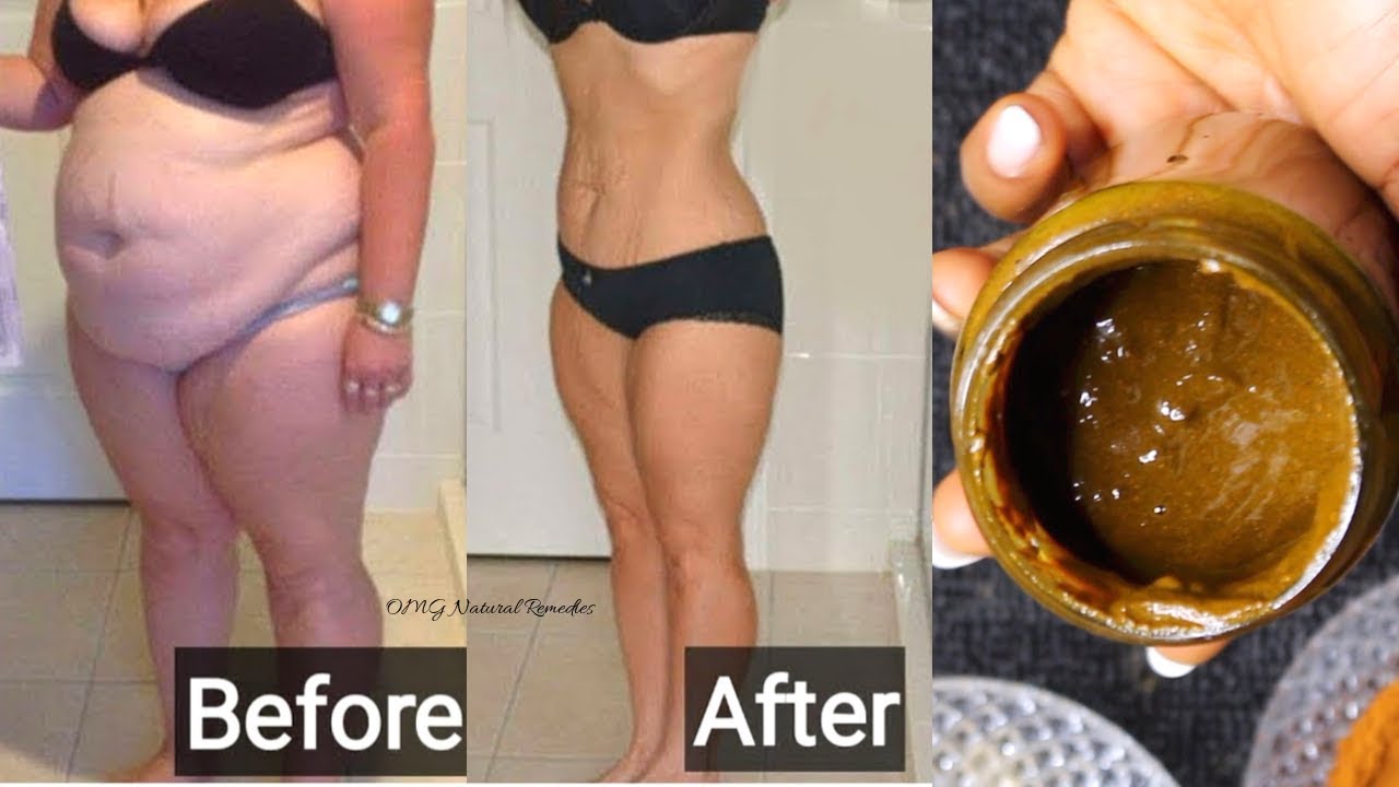 Turmeric Mix Burns Belly Fat in 5 Days II How To Make Turmeric Mix Tea